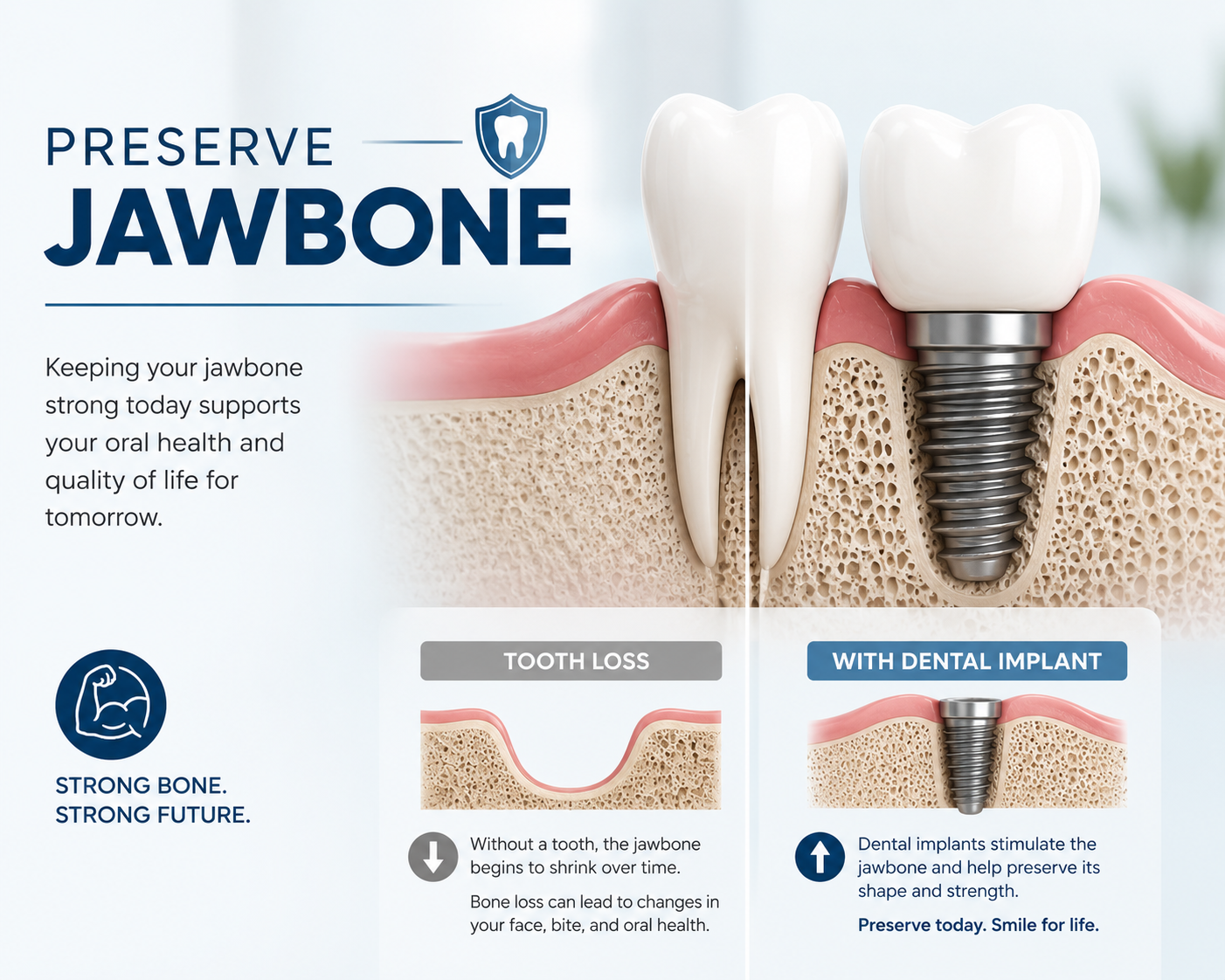 Preserve jawbone health with implants